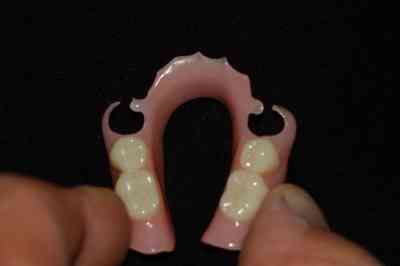 protesis dentales torremolinos