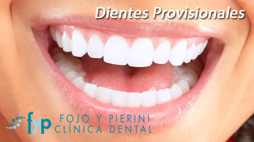 ¿Sabes qué son y para qué sirven los dientes provisionales?