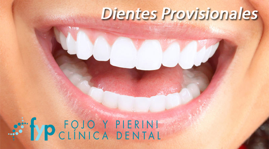 dientes provisionales