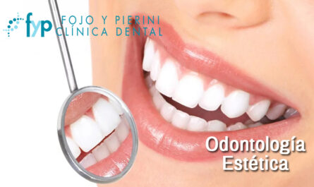 odontologia estetica torremolinos